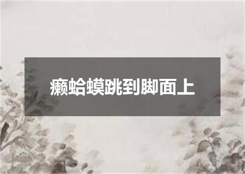 癞蛤蟆跳到脚面上